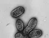 Winzig klein, aber todbringend: Eine elektronenmikroskopische Aufnahme zeigt das Pestbakterium Yersinia pestis