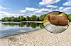 Der Junge trat am Eichbaumsee barfuß in einen Haufen Grillkohle und zog sich dabei schwere Verletzungen zu.