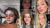 -S-er-Sonnenbrand-Apotheker-warnt-vor-gef-hrlichem-Internet-Trend