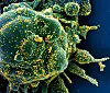 Eine mit dem Coronavirus infizierte Zelle.