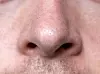 Die Nase ist ein unterschätztes Organ. (Symbolbild)