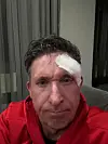 Ehemaliger Livepool-Spieler Robbie Fowler mit Verband über dem Auge