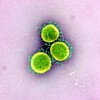 Das Coronoavirus SARS-CoV-2 unter dem Mikroskop (Symbolbild).
