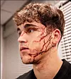Pau Cubarsi mit Blut im Gesicht